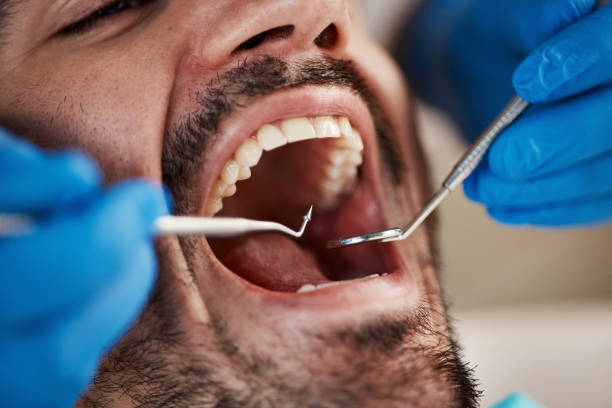 Best Knocked-Out Tooth Emergency  in Sawyerwood, OH