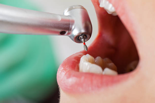 Best Broken Tooth Emergency  in Sawyerwood, OH
